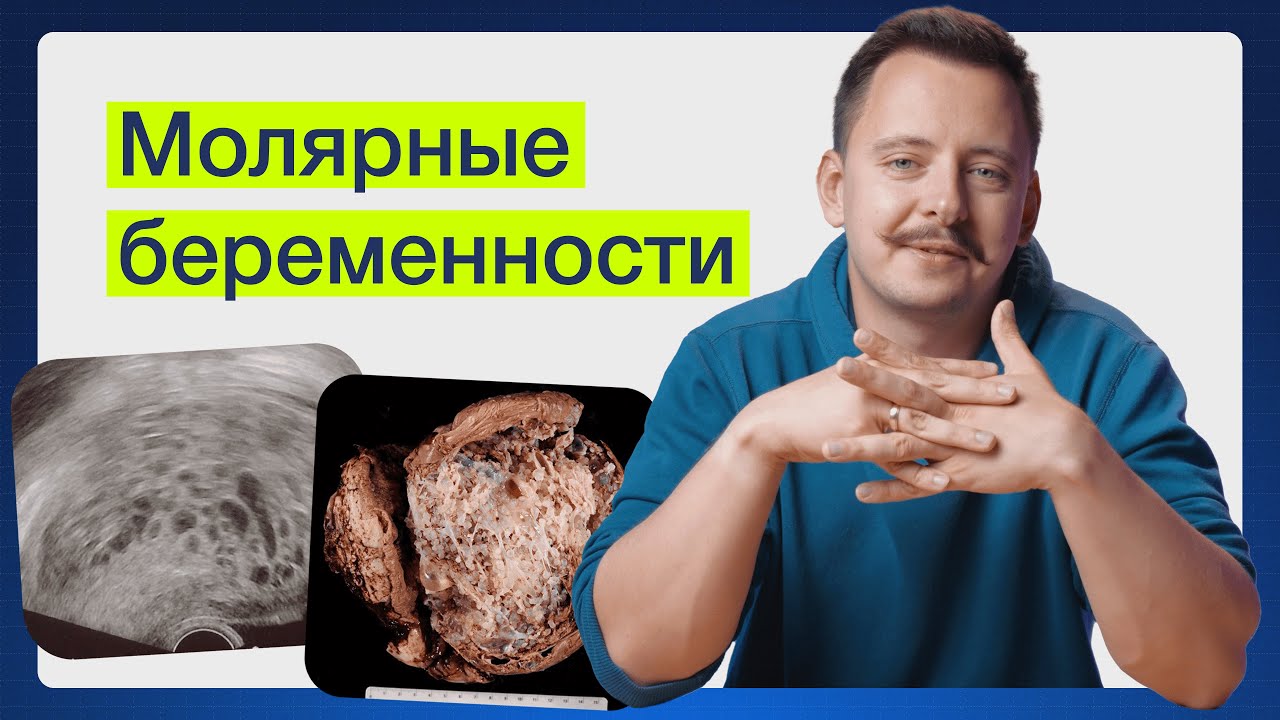 Когда беременность всё-таки болезнь?