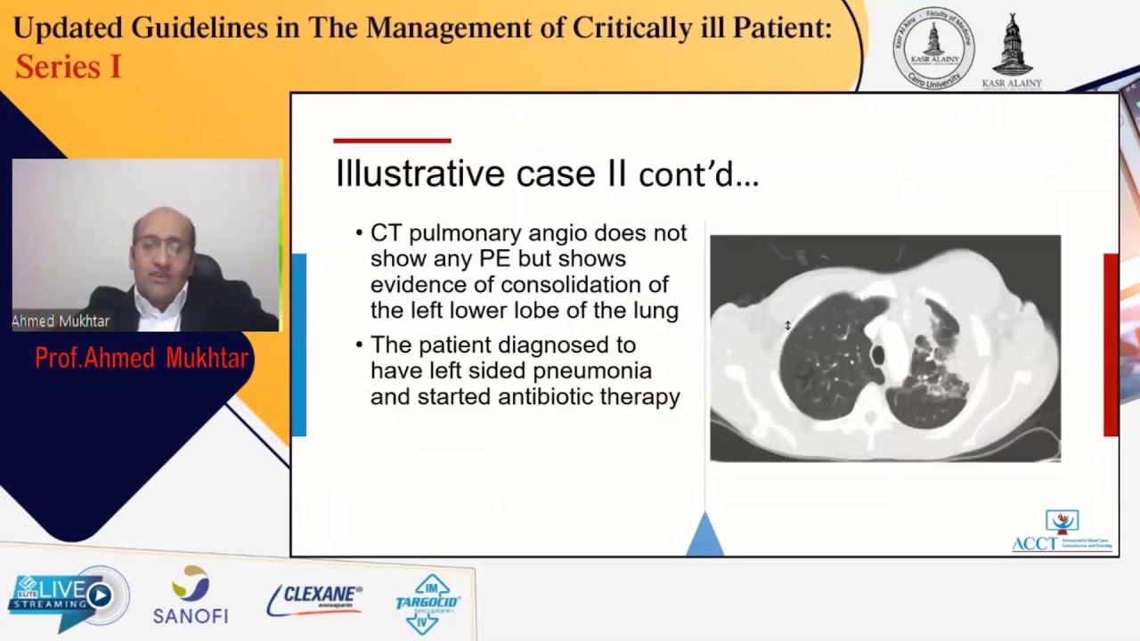 Management guideline of acute pulmonary embolism