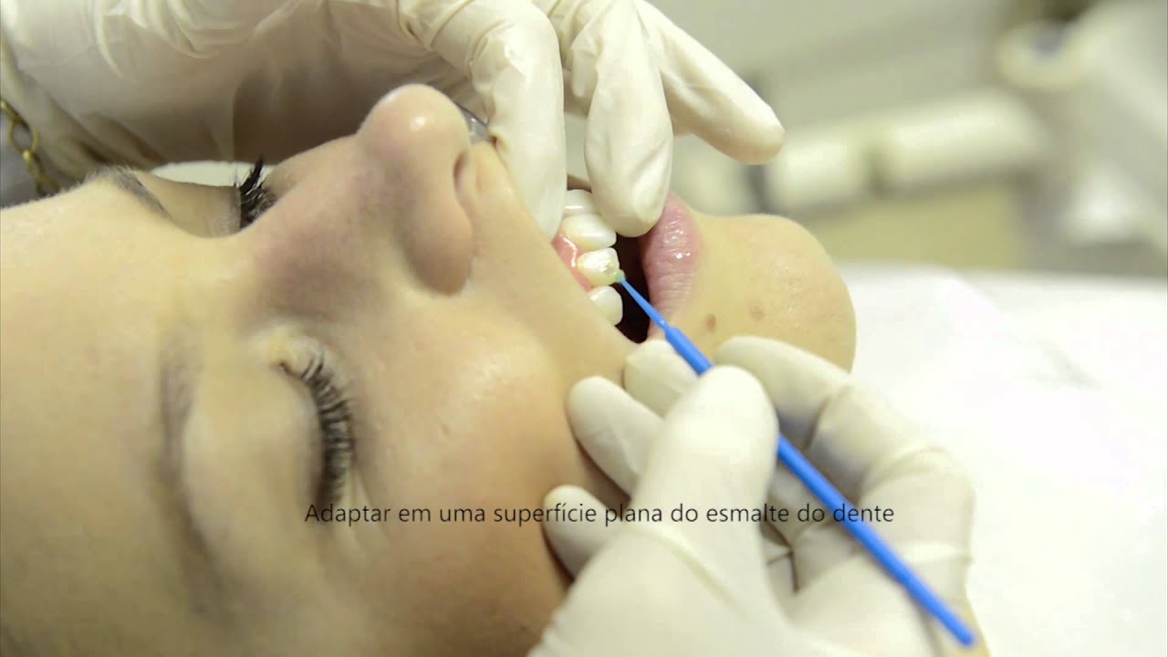 JOIA DENTAL - Instru&ccedil;&otilde;es 1