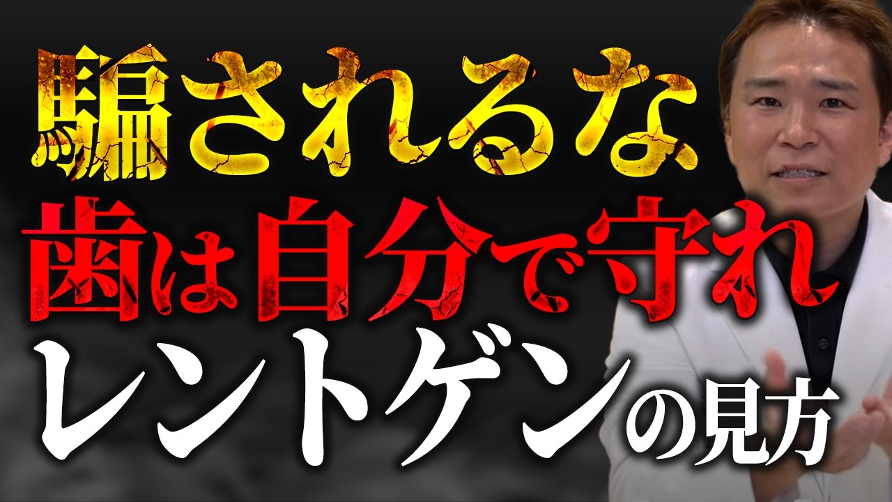 【暴露】悪徳歯科医師を返り討ちにするレントゲンチェックポイント
