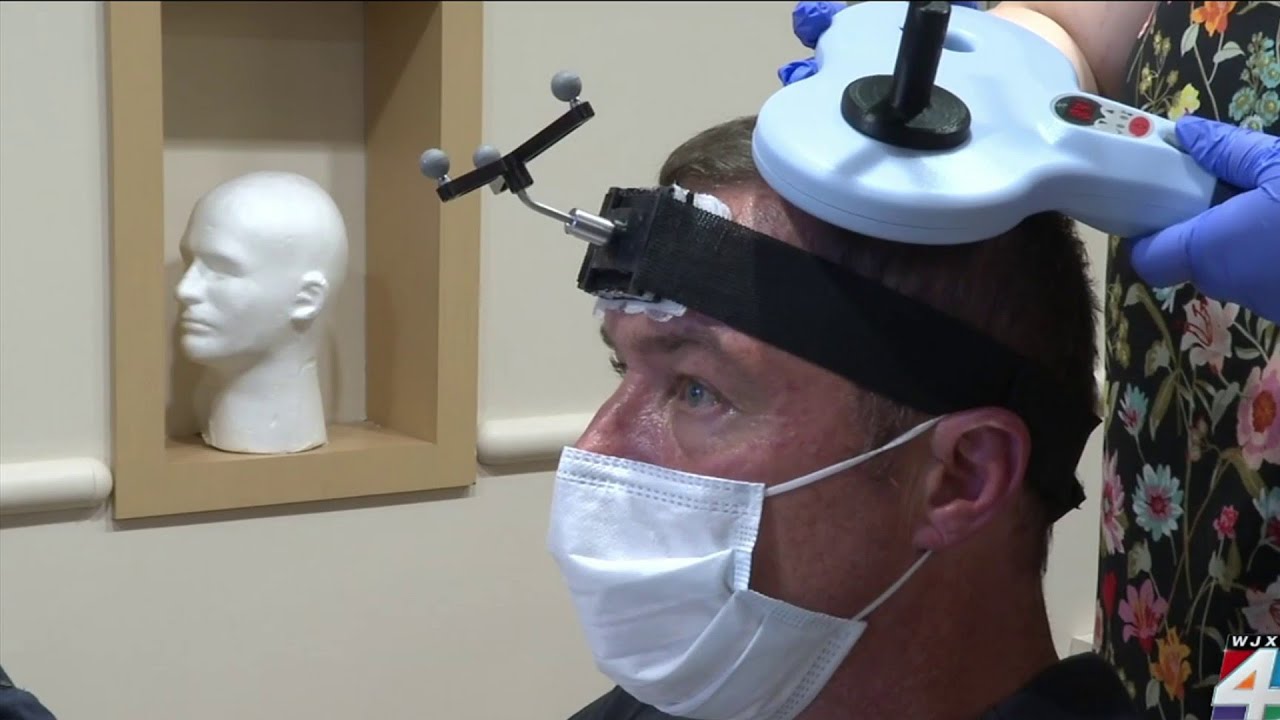 Deep brain simulation & stroke recovery
