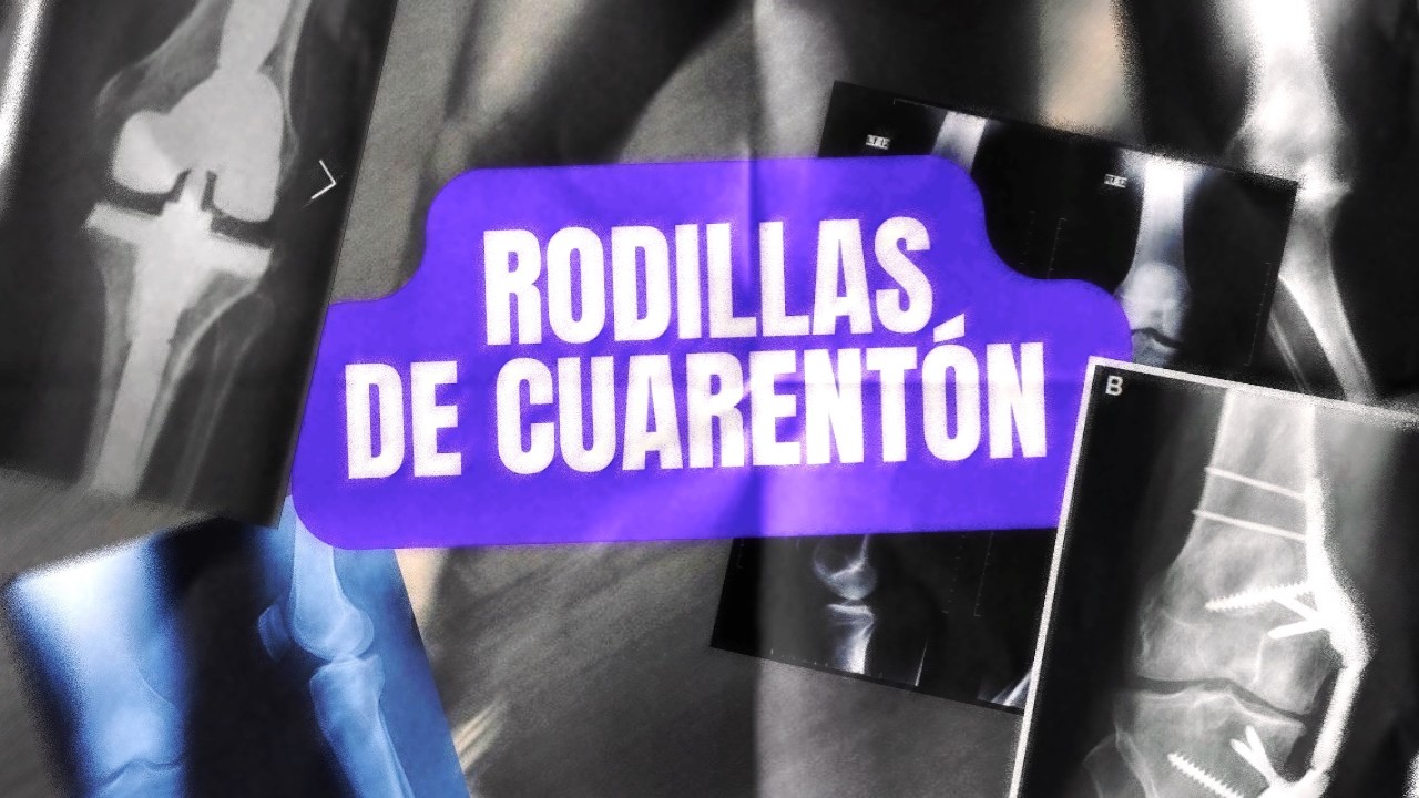 EL REINO II RODILLAS DE CUARENTÓN.