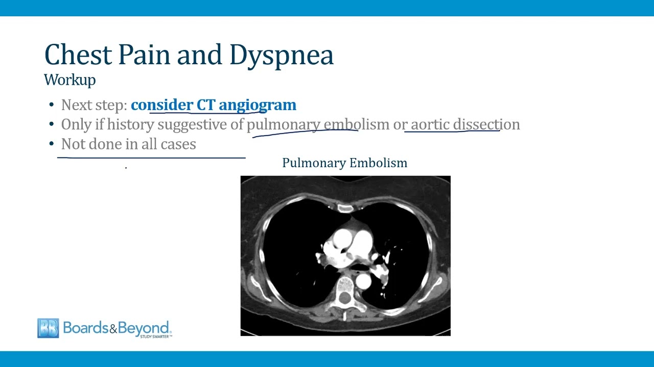 Emergency Medicine Step 2-3 &mdash; Chest Pain and Dyspnea &mdash; Boards and Beyond