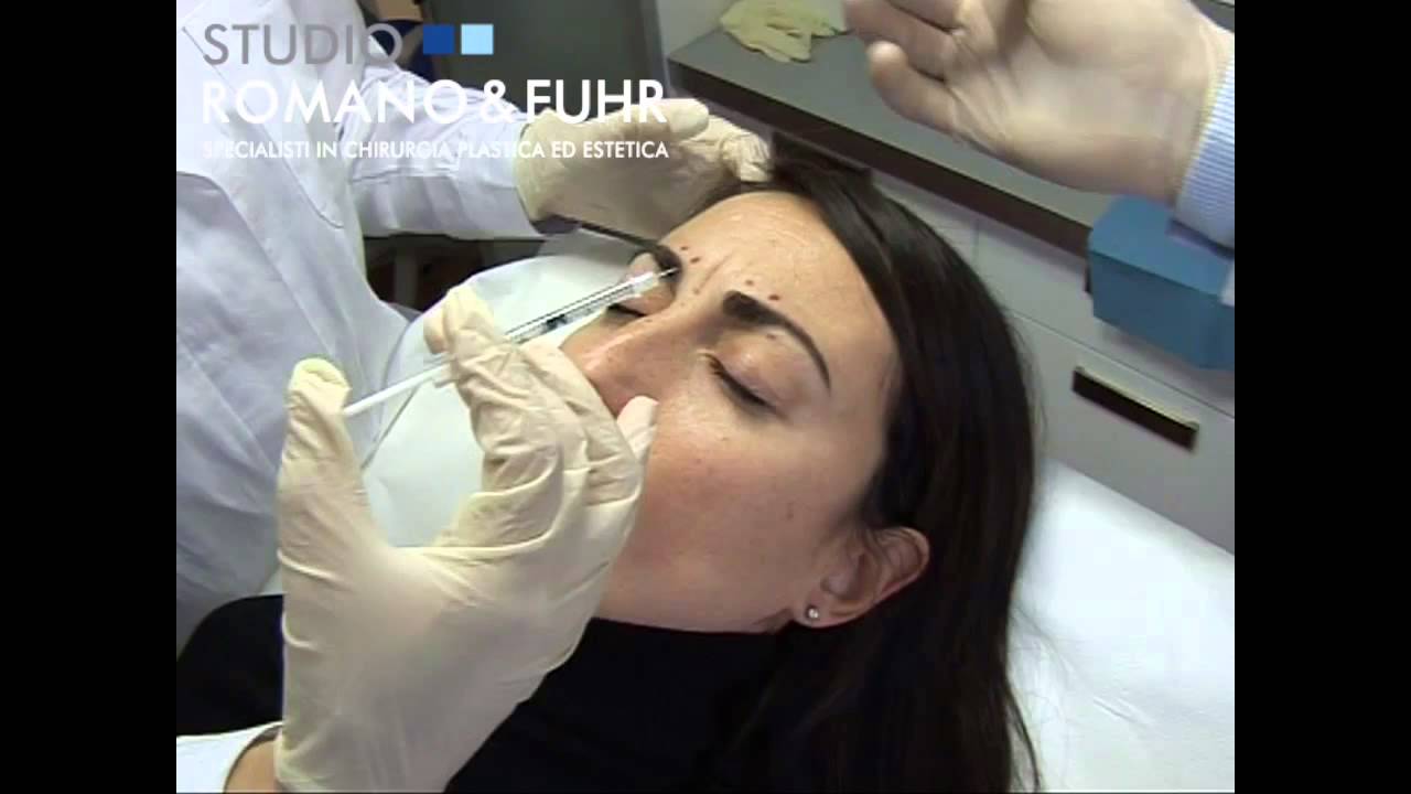 Botox del terzo superiore del volto