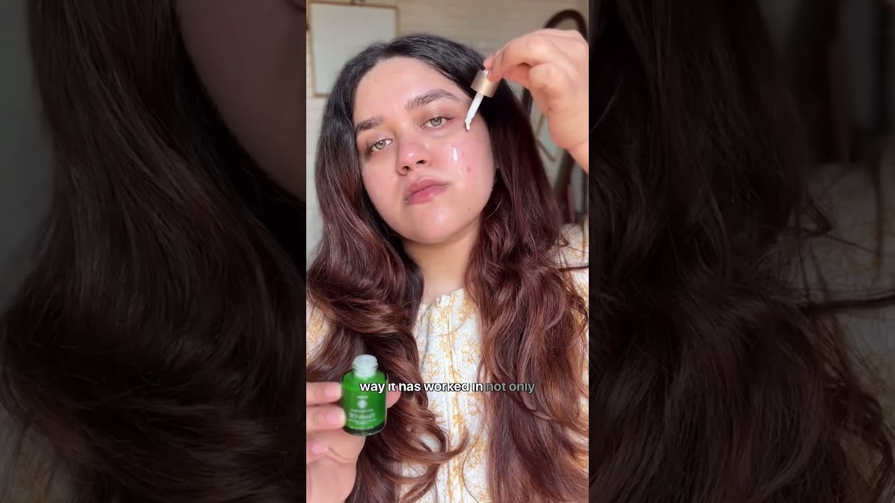 No more acne with Heads off Serum| Anti Acne| Indulgeo Essentials 💚