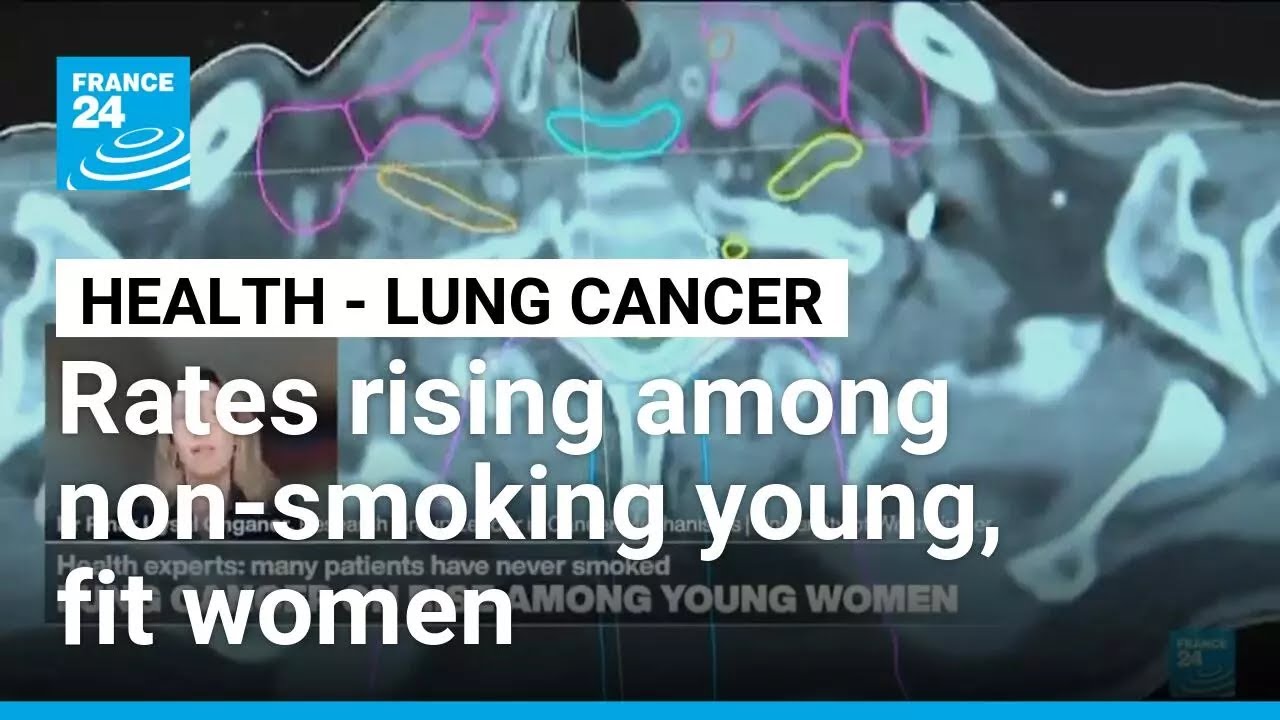 Why are lung cancer rates rising among young, fit women who have never smoked? &bull; FRANCE 24 English