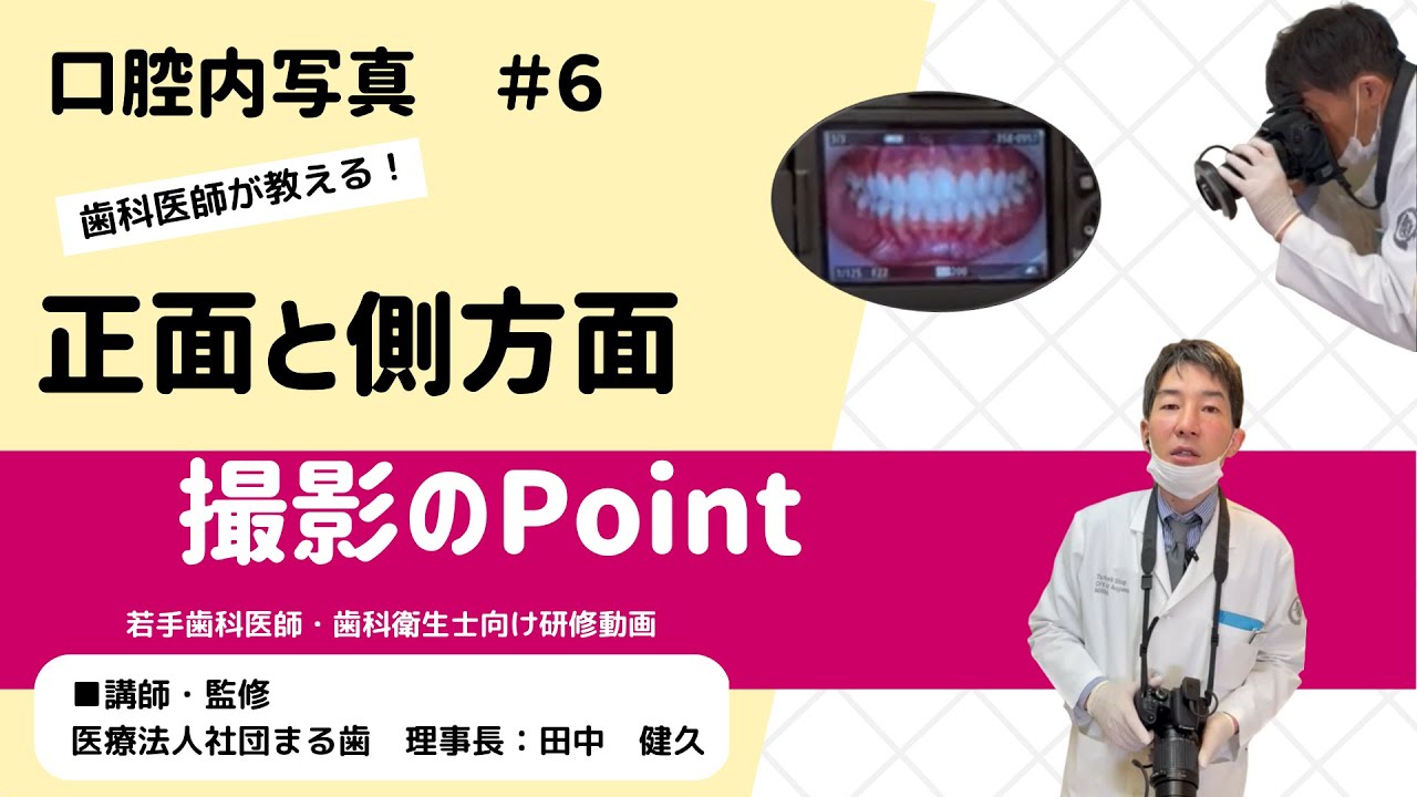 【歯科医院】研修動画│口腔内写真#6「正面と側方面の撮影ポイント」