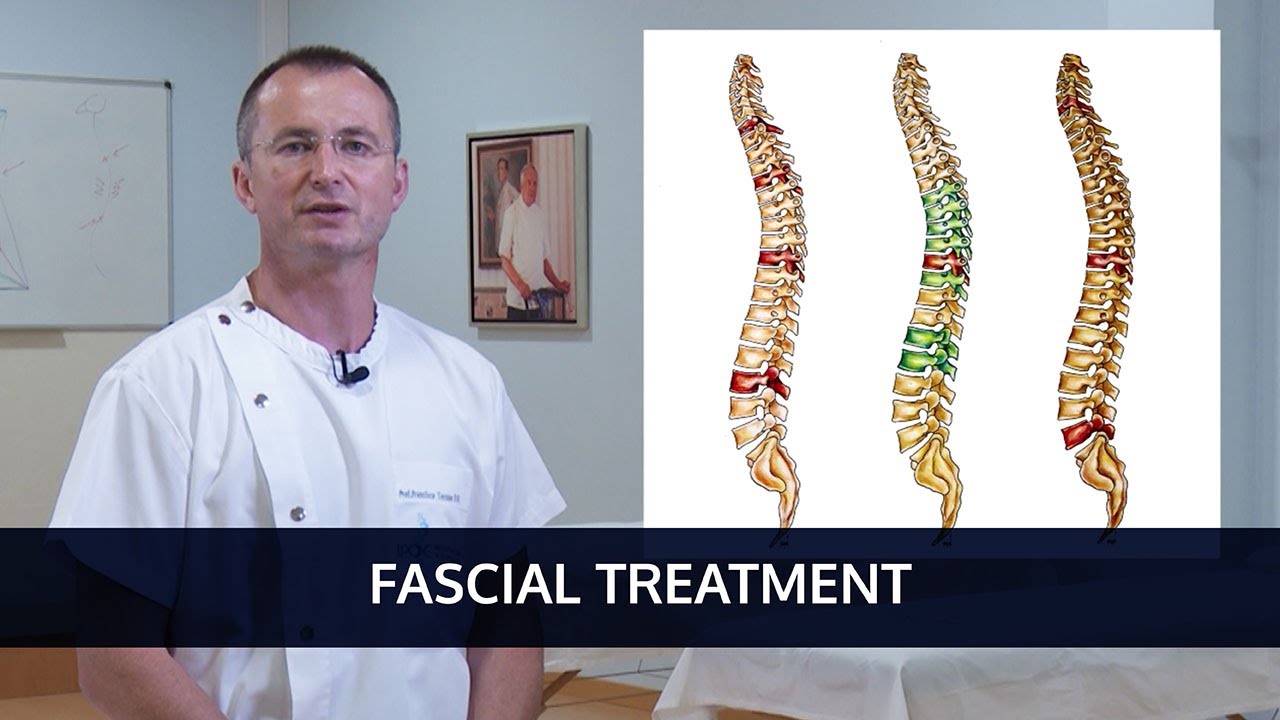 Fascial Treatment - IPOC