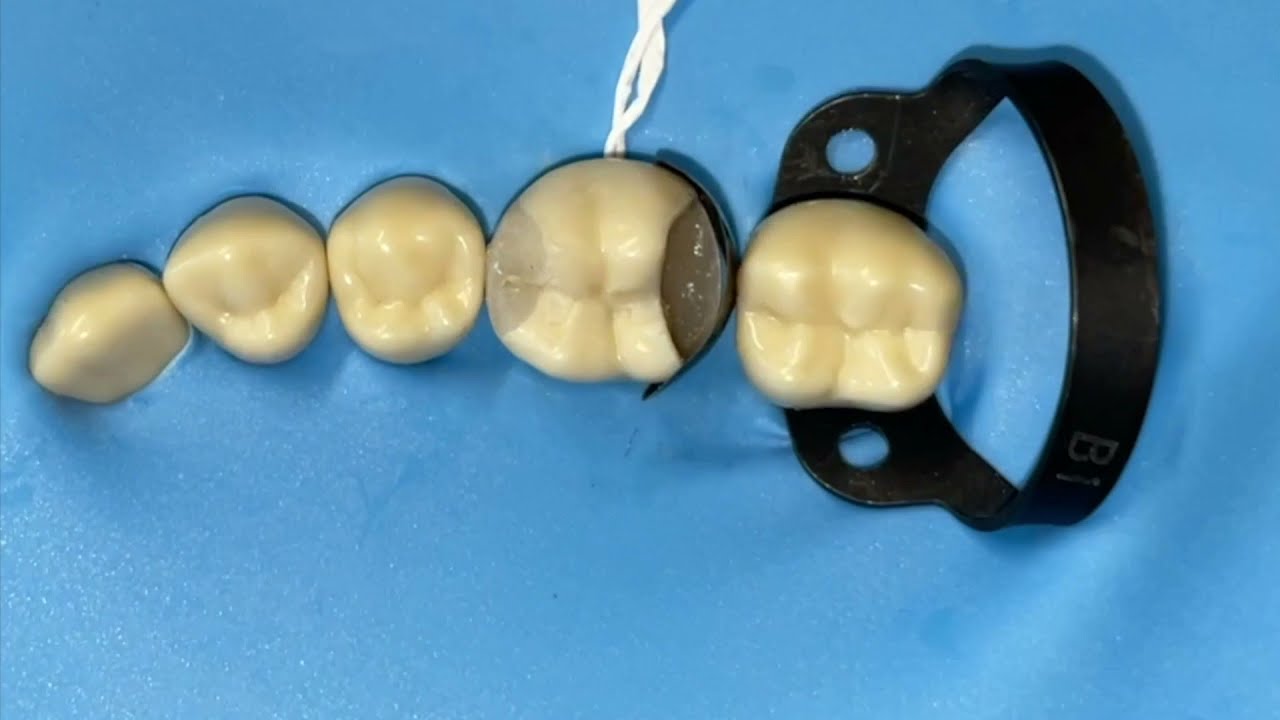 Incidental Composite Course Reviews