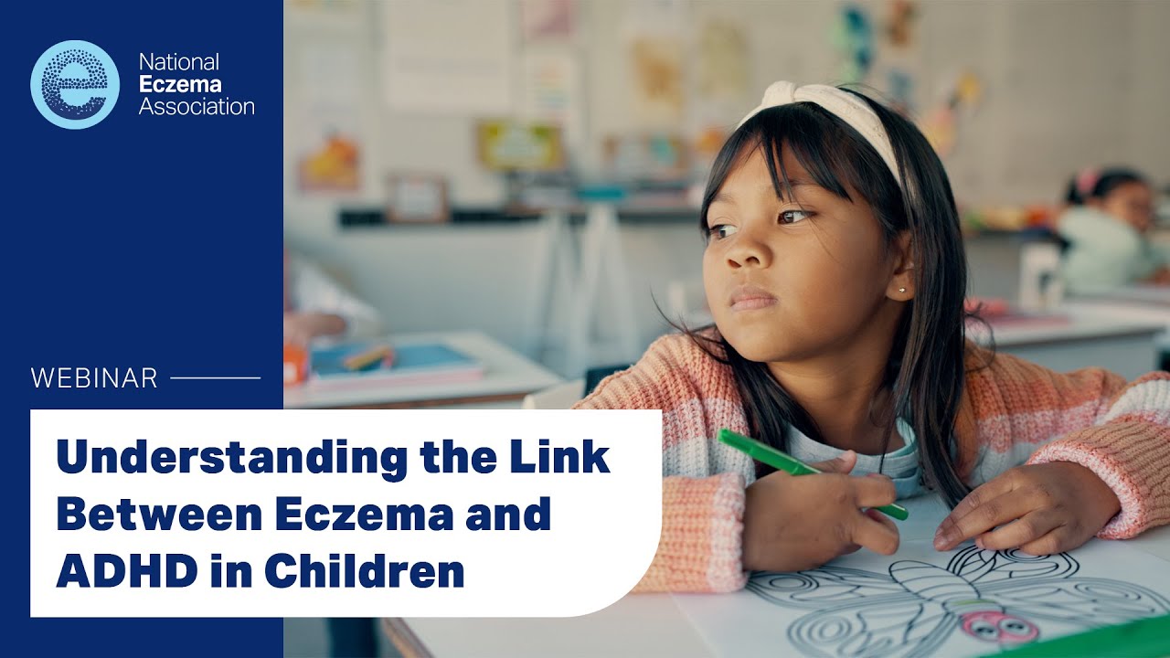 Understanding the Link Between Eczema and ADHD in Children