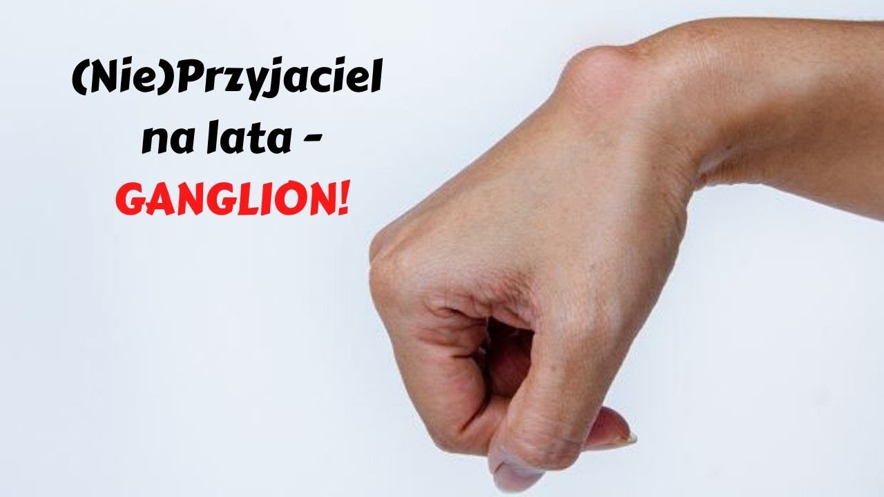 Zdrowy Gracz: Ganglion