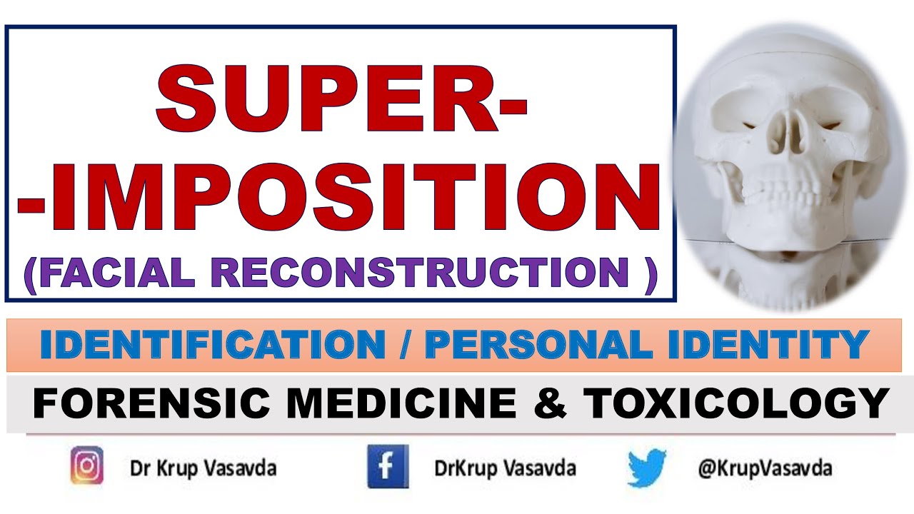 Superimposition | Forensic Facial reconstruction | Dr Krup Vasavda