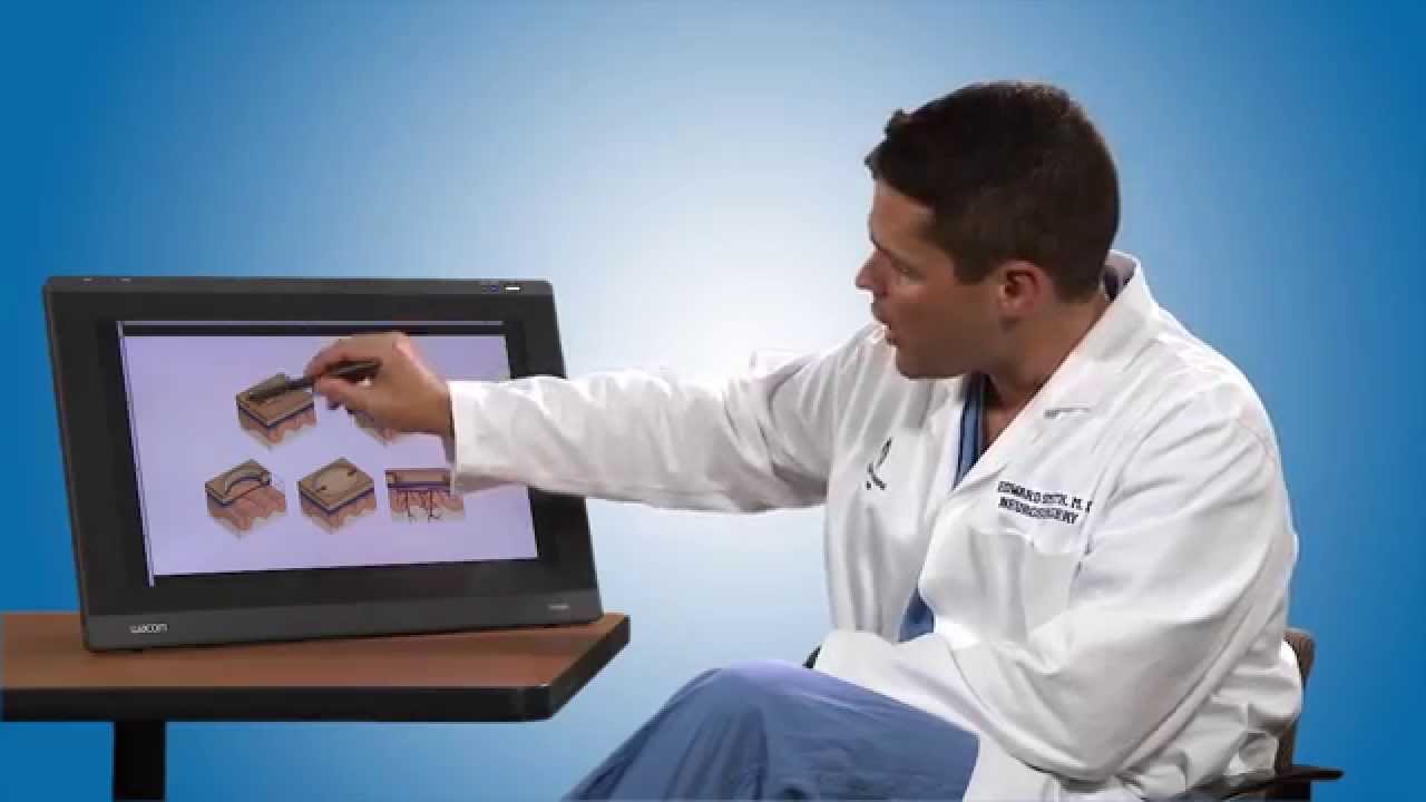 Moyamoya disease diagnosis and treatment | Boston Children’s Hospital