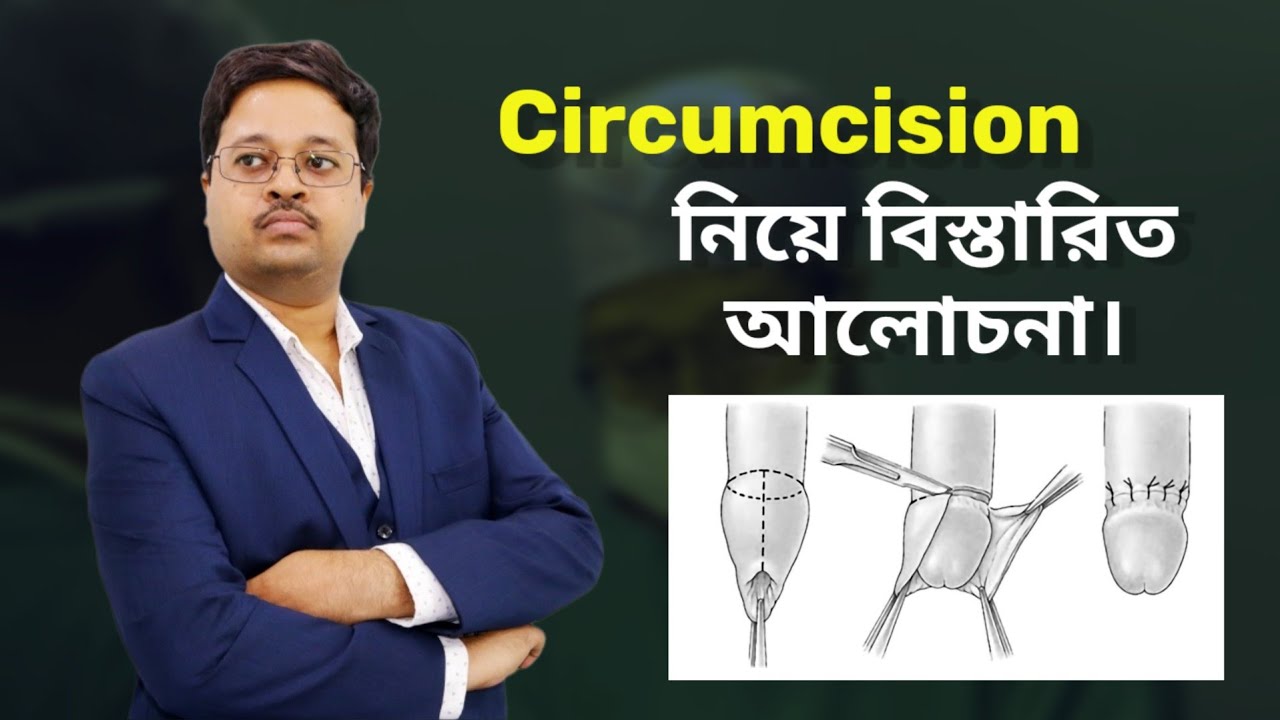 Circumcision নিয়ে বিস্তারিত আলোচনা  | Best ZSR Circumcision in Kolkata | Dr. Jayanta Bain