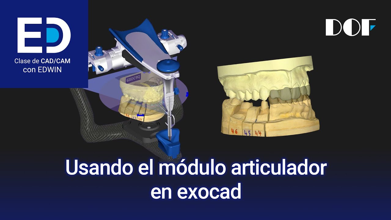 Usando el módulo articulador en exocad