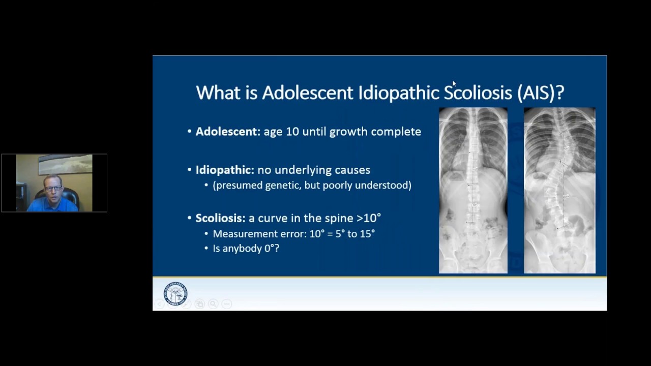 SRS Patient Webinar: Operative Treatment Options for Adolescent Idiopathic Scoliosis