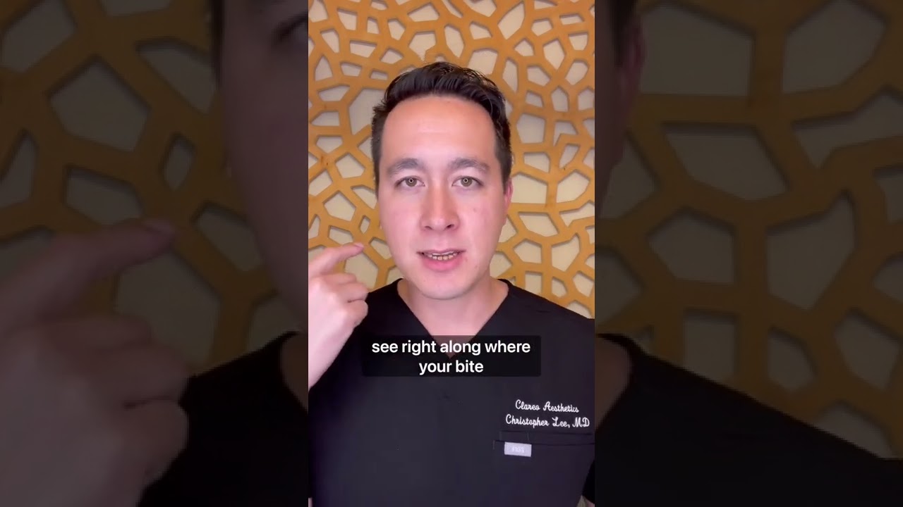 Buccal Fat Removal Procedure Secrets | Clareo Plastic Surgery