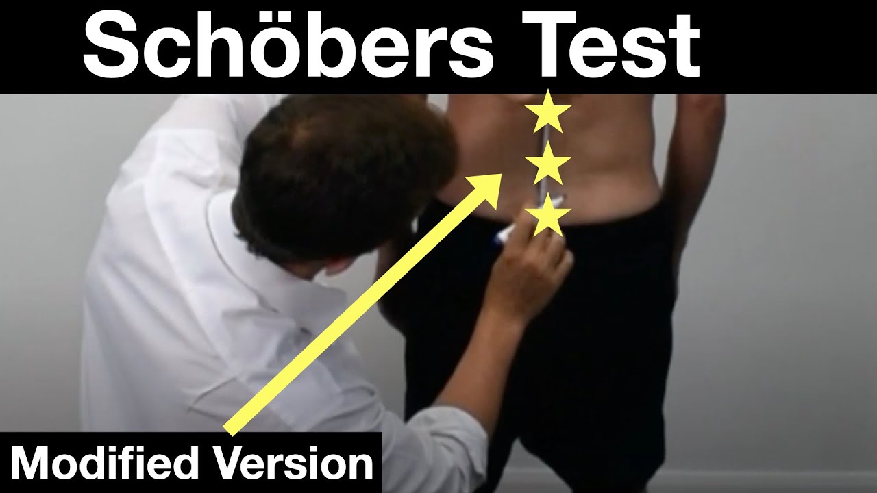 Modified Schöber Index. Schöbers test for Lumbar Flexion / Ankylosing Spondylitis.
