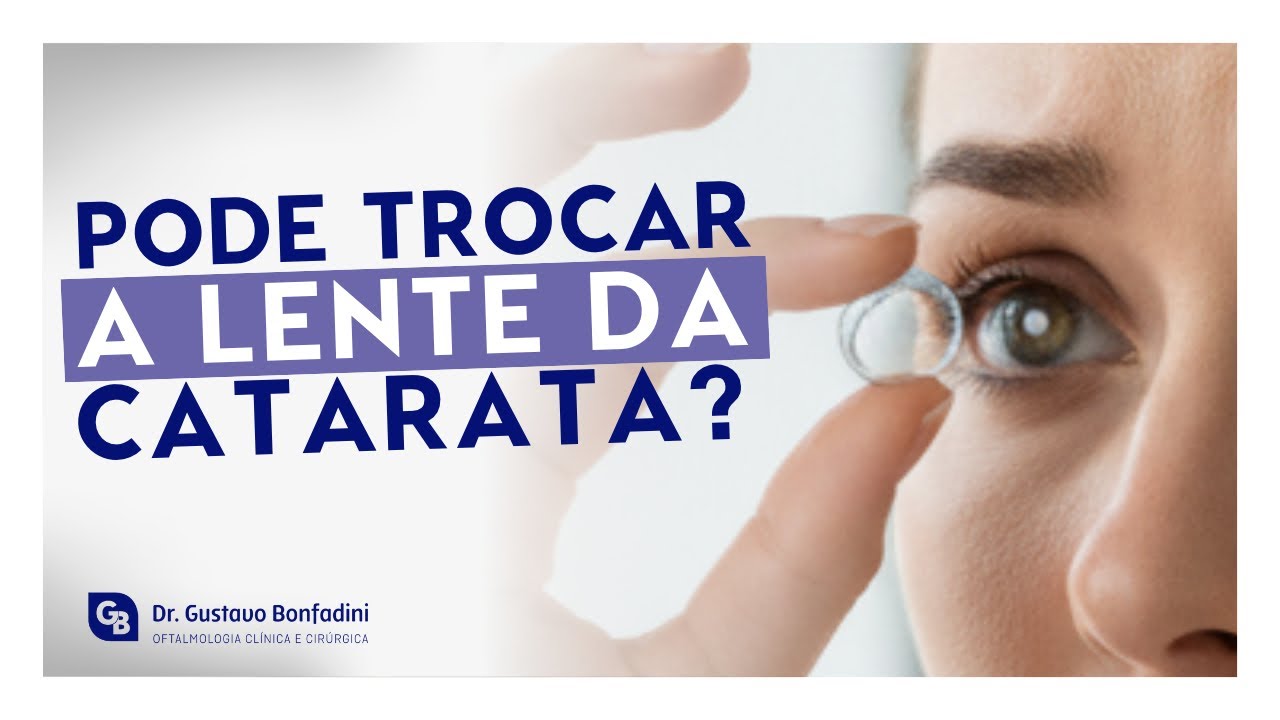 POSSO TROCAR A LENTE DA CIRURGIA DE CATARATA? A VERDADE QUE NINGUÉM TE CONTA!
