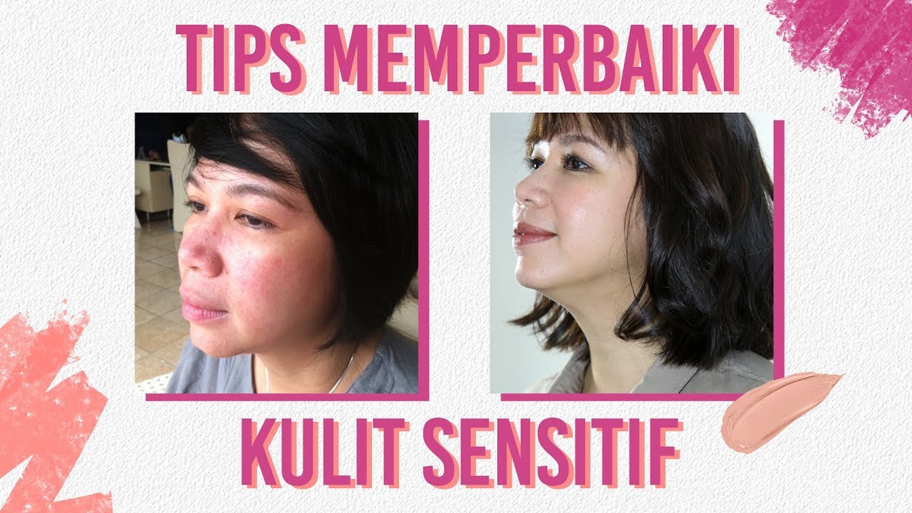 Tips Mengatasi Kulit Sensitif | Skincare 101