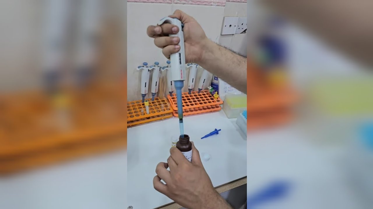 تحليل ابو صفار (البيليروبين في الدم) TSB Test (jaundice)