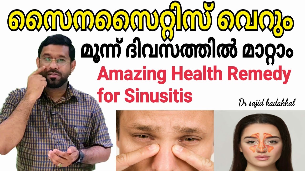 Amazing Health Remedy for Sinusitis, സൈനസൈറ്റിസ് മാറ്റാം വെറും മൂന്ന് ദിവസത്തിൽ, Tips for Sinusitis