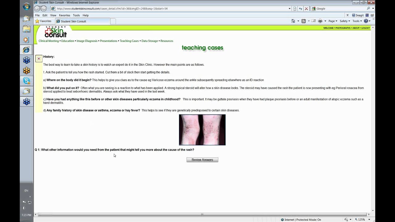 Student Skin Consult - Taking a Skin History