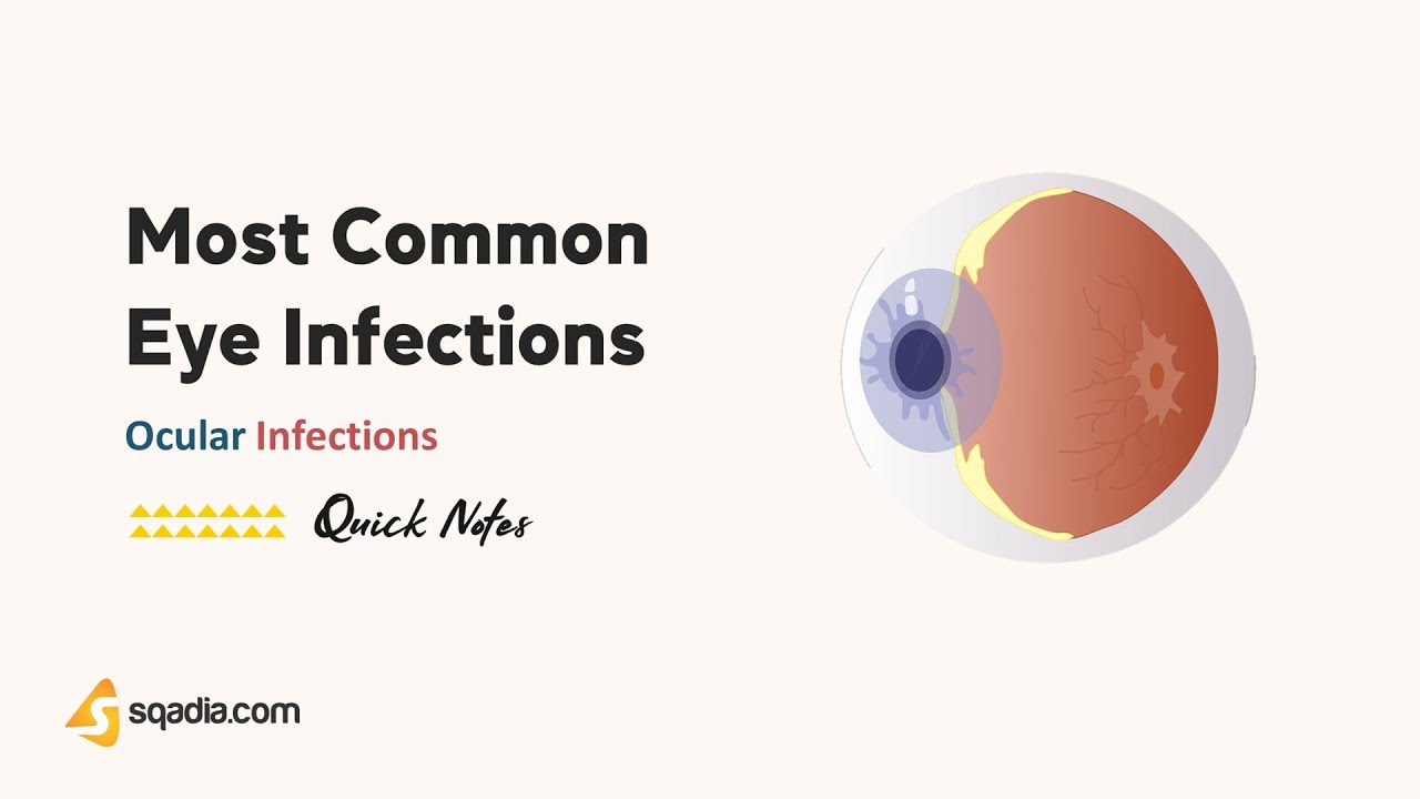 Ocular Infections | Most Common Eye Infections