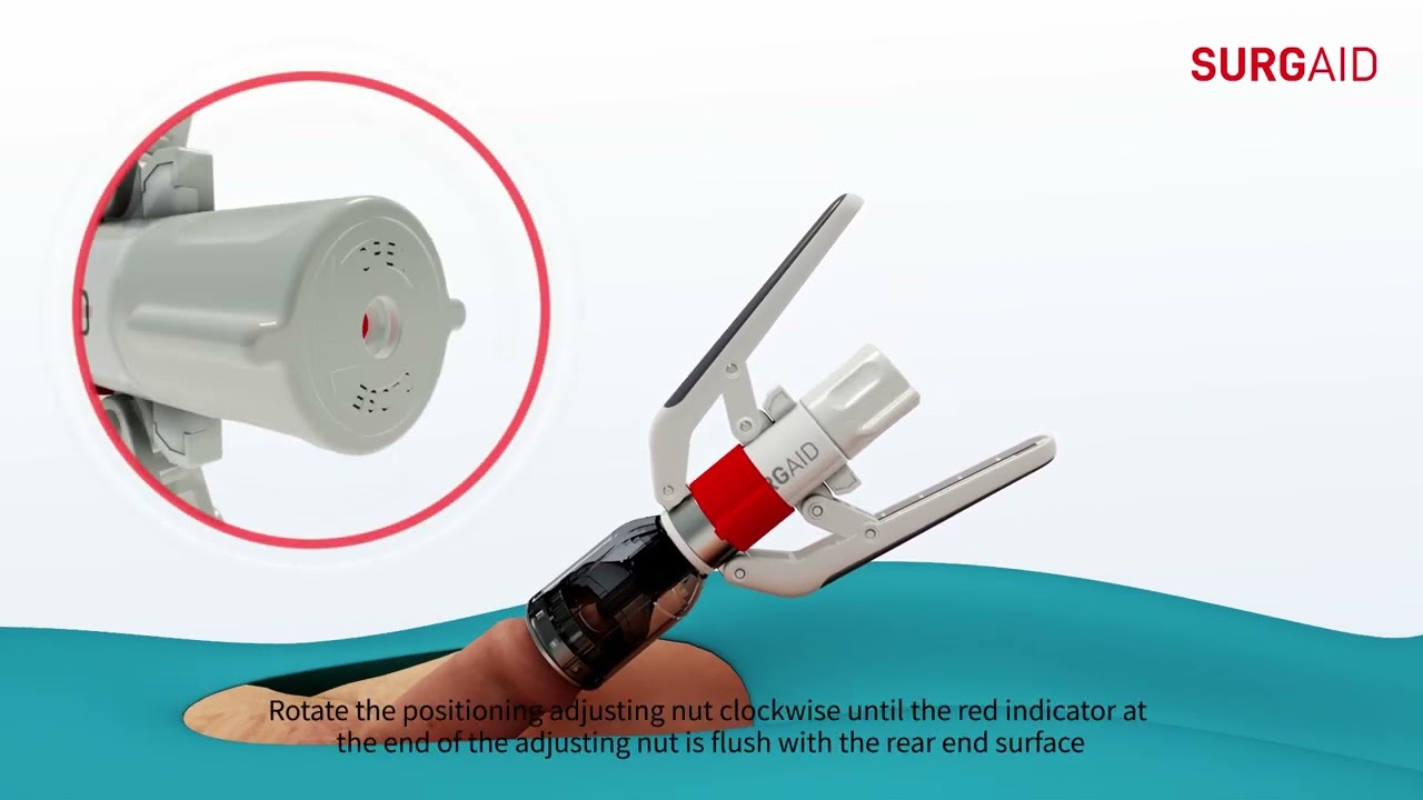 SINGLE USE CIRCUCISION STAPLER FORESKIN Scissor Type