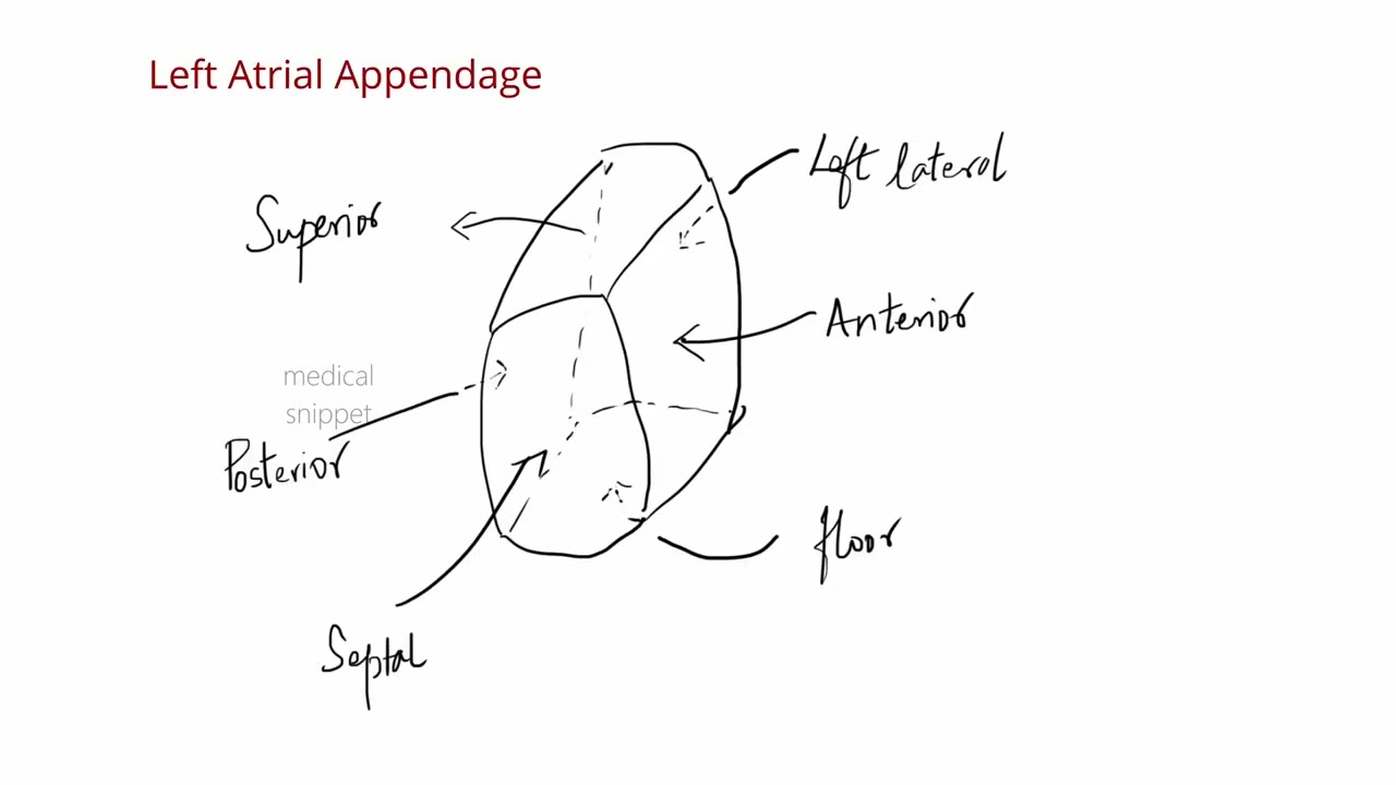 Left Atrium Anatomy (Cardiac Morphology: Chapter 3)
