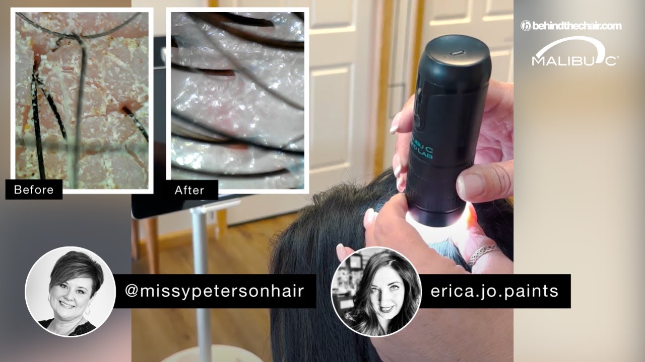 How To Use A Scalp Scope For Your Clients
