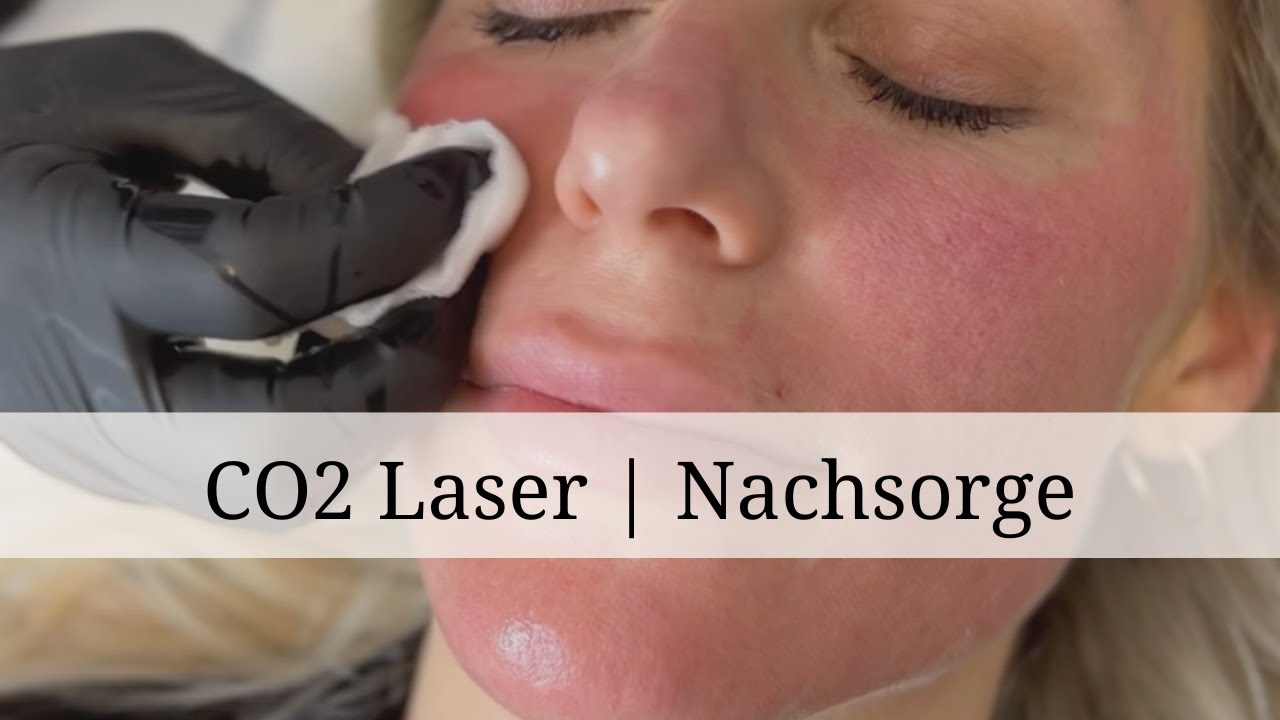 CO2 Laserbehandlung Nachsorge | Dr. Ben Gehl