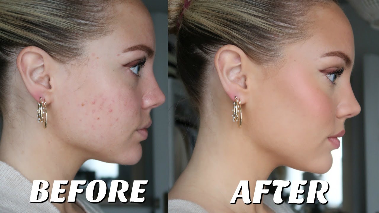 HOW TO COVER ACNE/LONG LASTING MAKEUP || Elanna Pecherle 2020