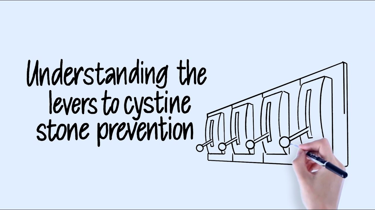 Understanding the Levers to Cystine Stone Prevention