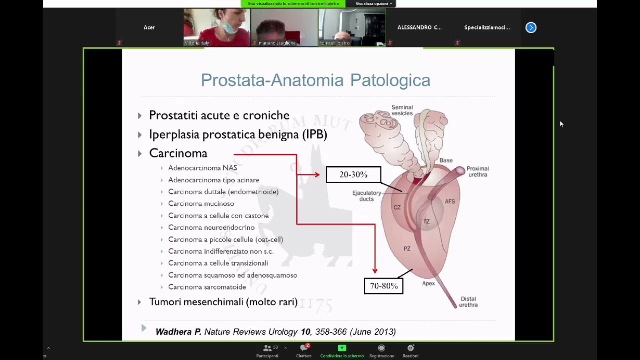 21.24) L'imaging della patologia prostatica - Prof  Pietro Torricelli