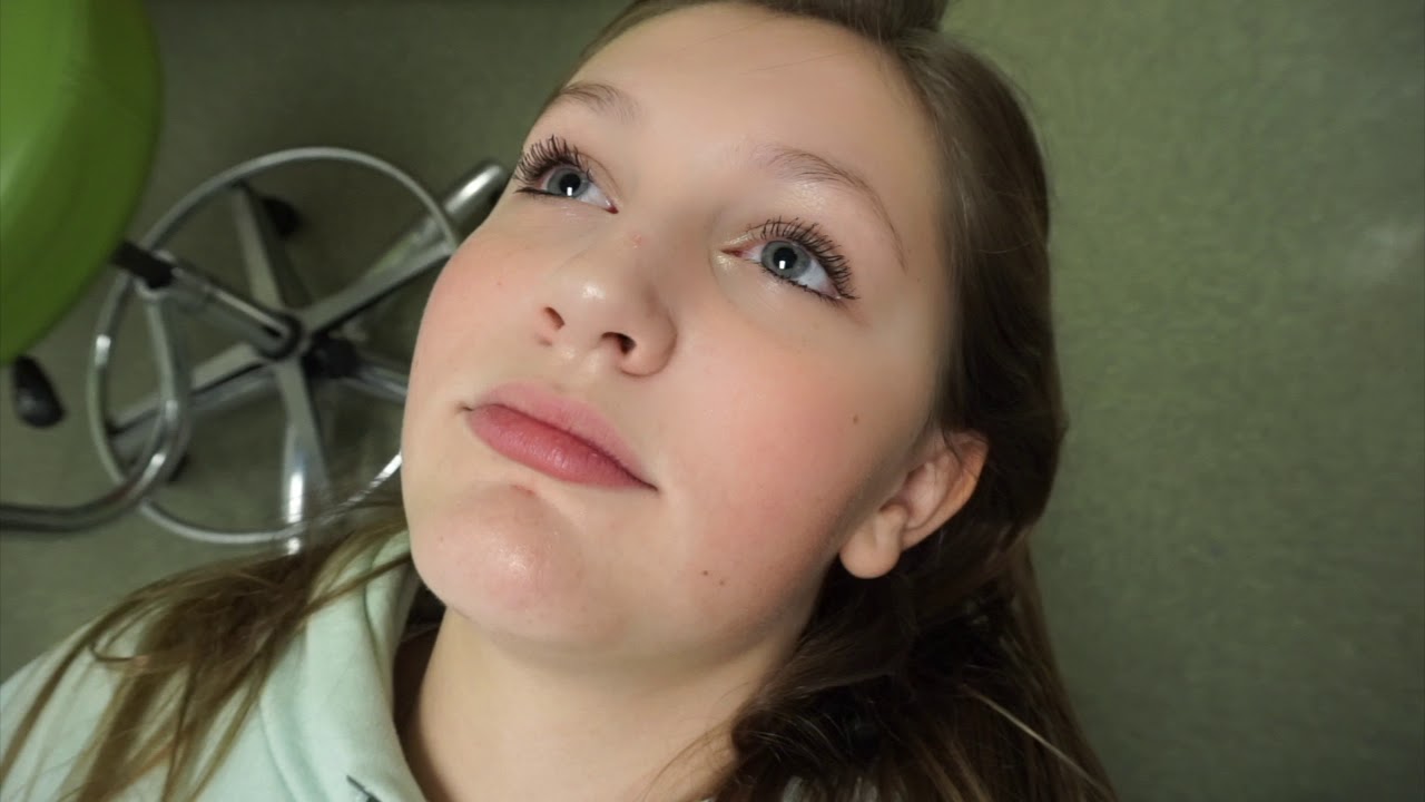 Braces UPDATE: Getting My First Power Chain