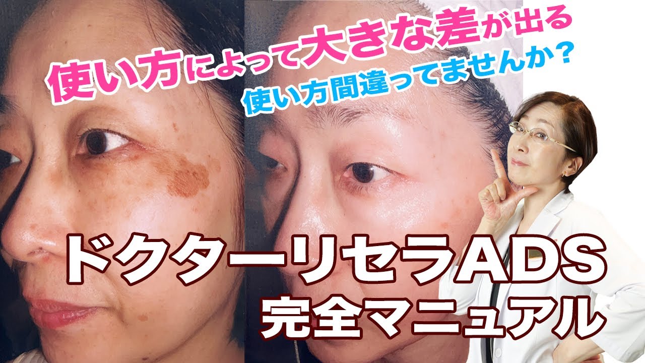 【保存版】Dr.リセラADSについて使用方法を徹底解説