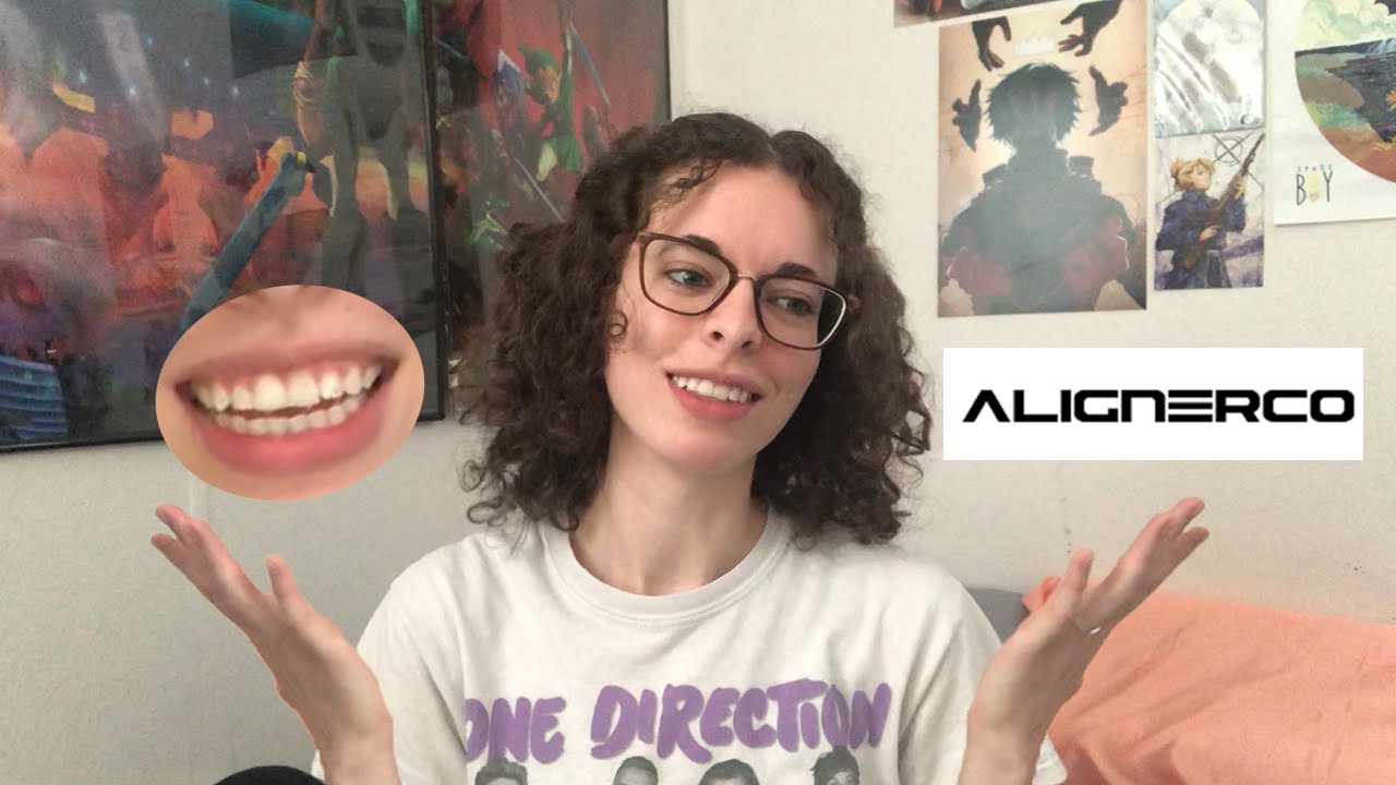 ALIGNERCO Review (honest, non-sponsored!) (Vlog #2 :D)