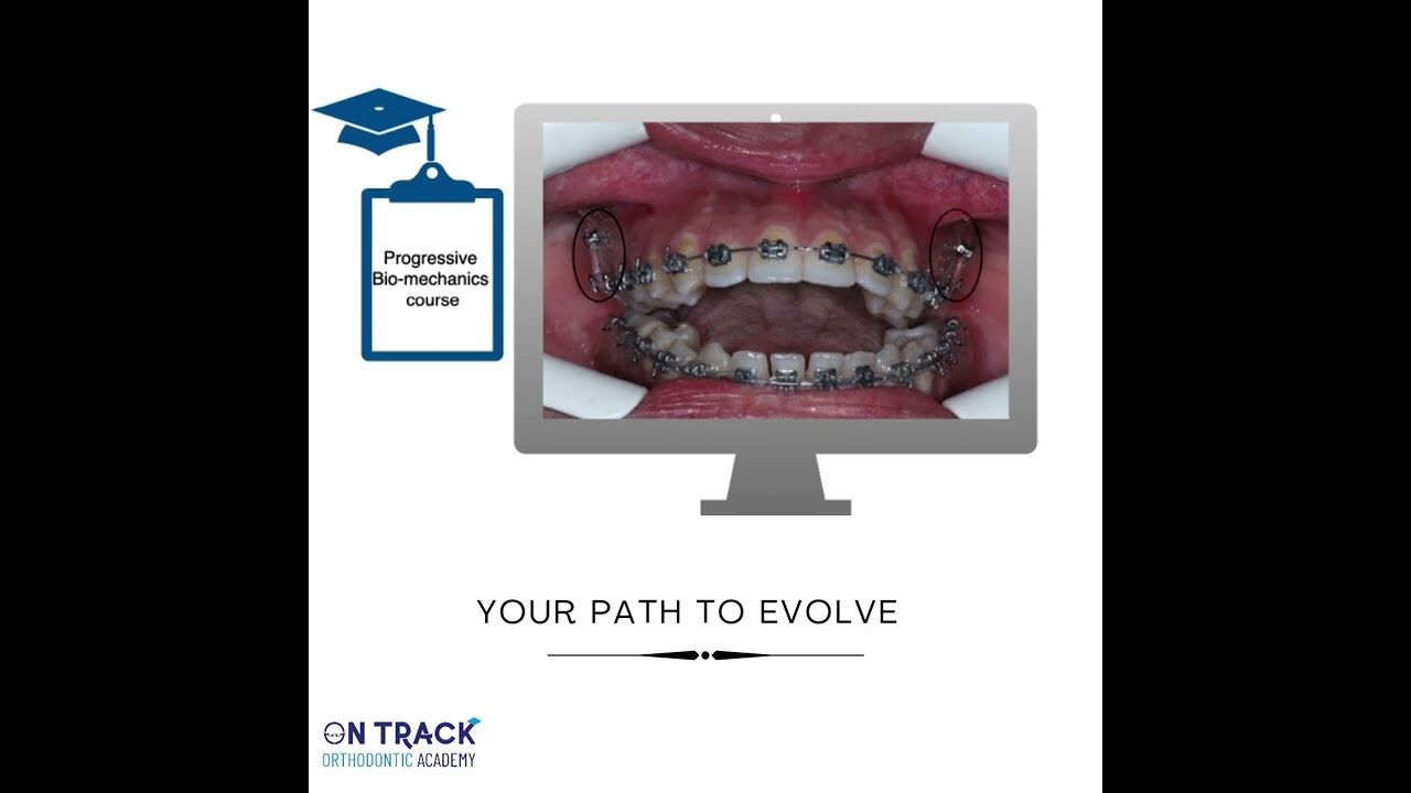 on track orthodontic academy