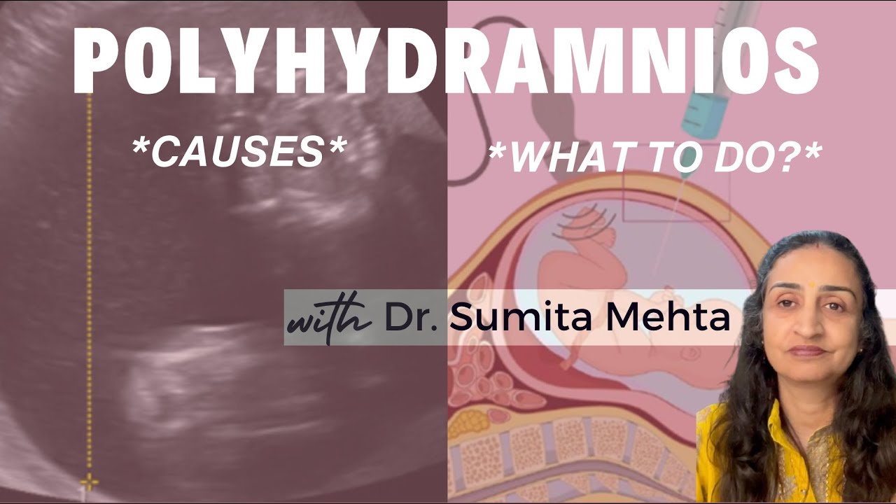 Increased Amniotic Fluid in Pregnancy: Why it happens, complications & how to treat it
