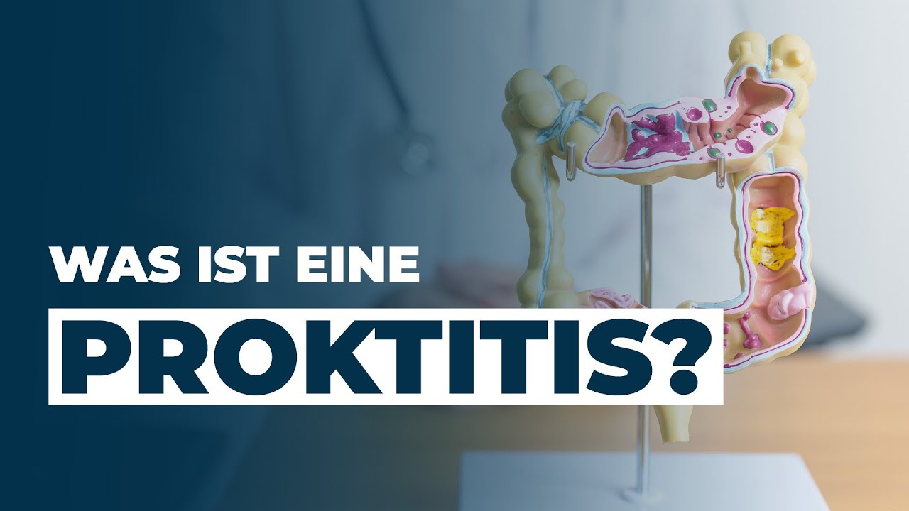 Was ist eine PROKTITIS? Dr. Eduard Karsten klärt auf