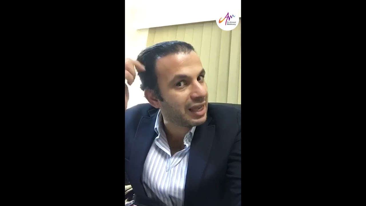 زراعة الشعر للخط الأمامي للسيدات مع الدكتور أحمد مكاوي