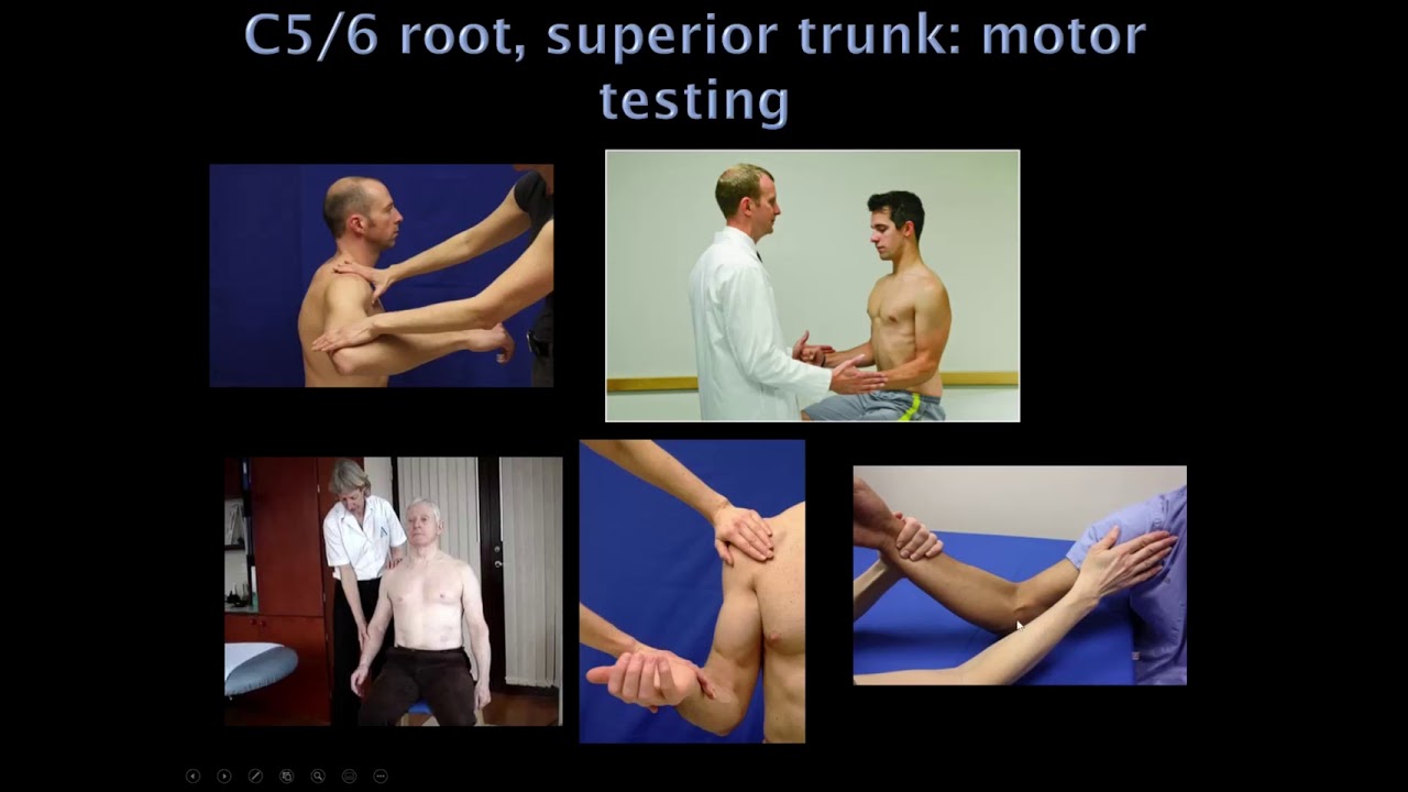 5. Quick Reviews: Radiculopathies and Plexopathies