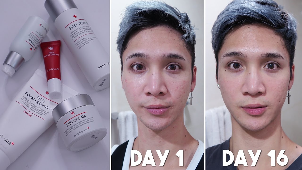 Skincare for Acne Prone Skin: Medicube Brand Review- Edward Avila