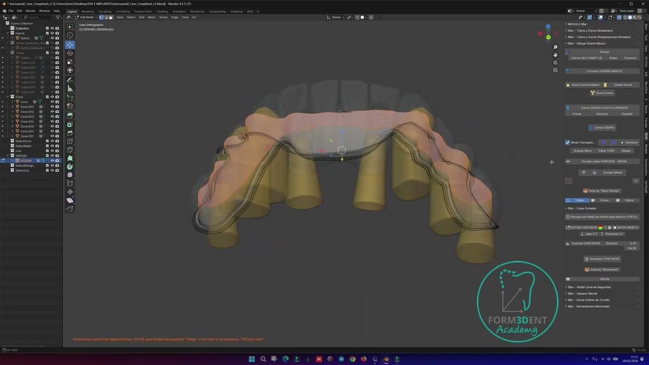 SEGMENTACION DE FIJA E IMPLANTES