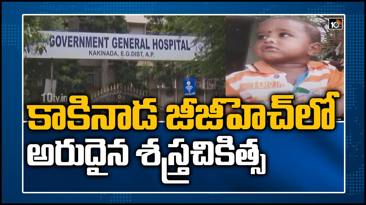 కాకినాడ జీజీహెచ్ లో అరుదైన శస్త్రచికిత్స | Rare Surgery For Removal of Black Fungus At Kakinada GGH