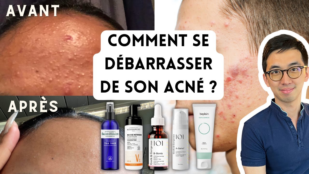 PEAU SANS ACN&Eacute; : BOUTONS BLANCS OU ROUGES, MICROKYSTES, PLAQUES DE BOUTONS, PAPULES, PUSTULES,...