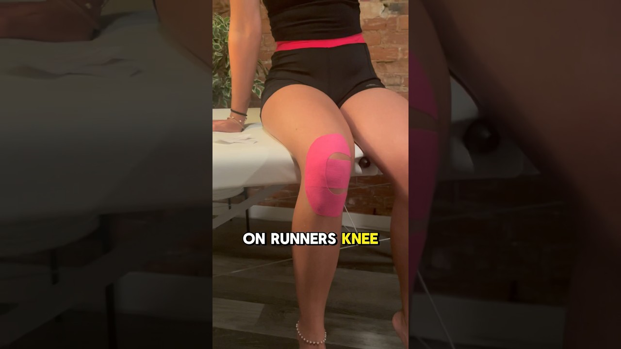 🌟 Kinesiotaping for Patellofemoral Pain Syndrome (PFPS) 🌟