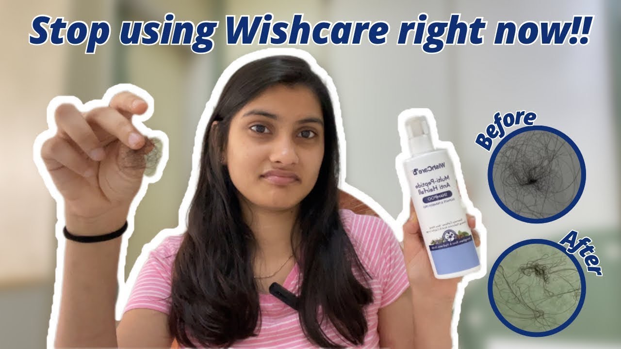 This Anti-Hairfall shampoo can make you go Bald... 😢 Stop using this right now!