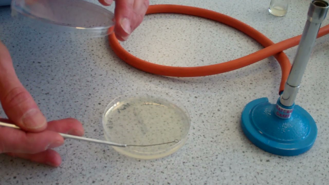 Streaking Bacteria to single colonies